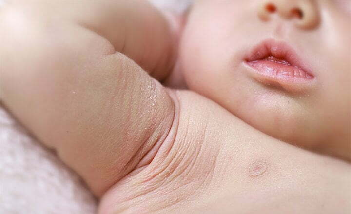 Primer plano de los pliegues de la axila del recién nacido